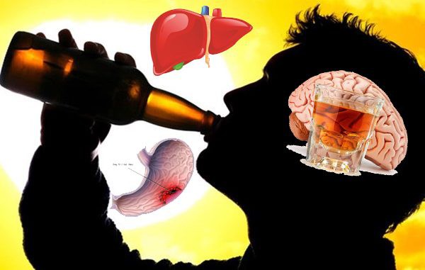 Sử dụng rượu bia thường xuyên dễ gây độc cho gan